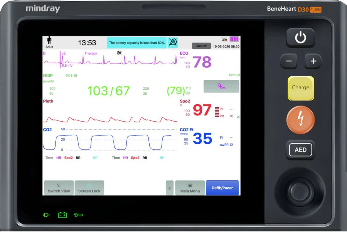 Mindray monitor